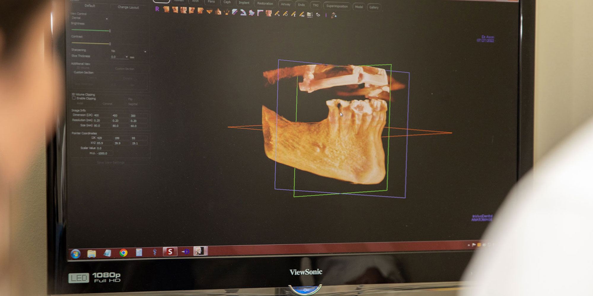digital image of patient jaw being viewed by doctors