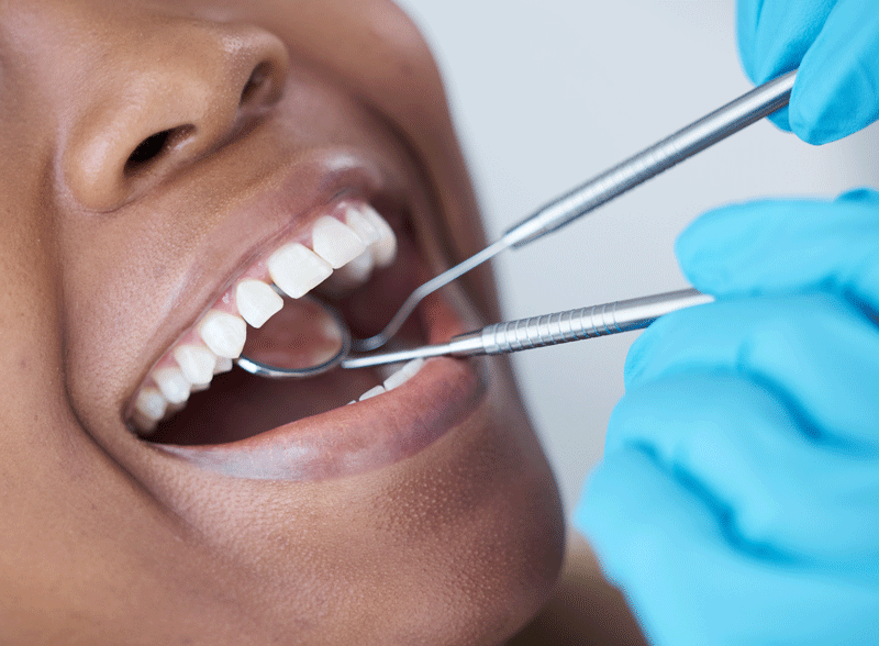 Close-up of a female doctor pointing at teeth x-ray image at dental office.